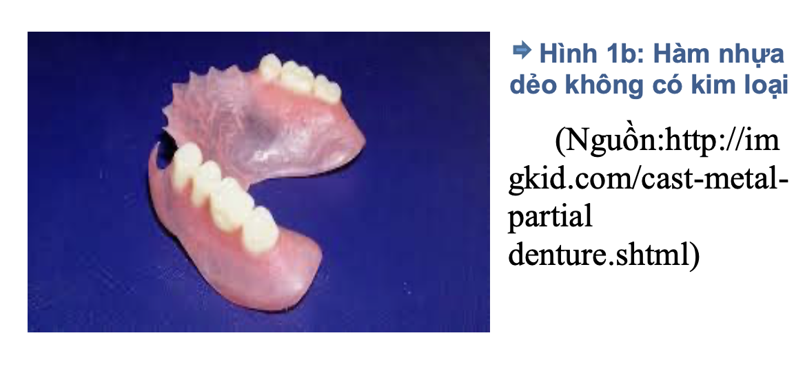 Hàm nhựa dẻo trong phục hình tháo lắp: Đặc tính, chỉ định và biến chứng lâm sàng